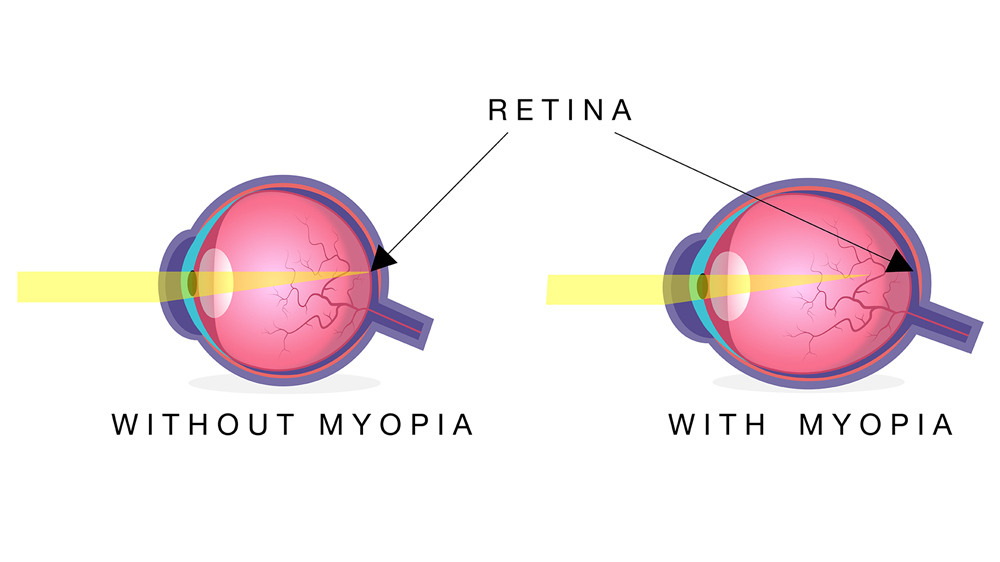 Sai Opticians
